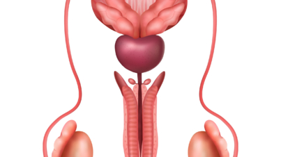prostat-tani-ve-tetkikleri