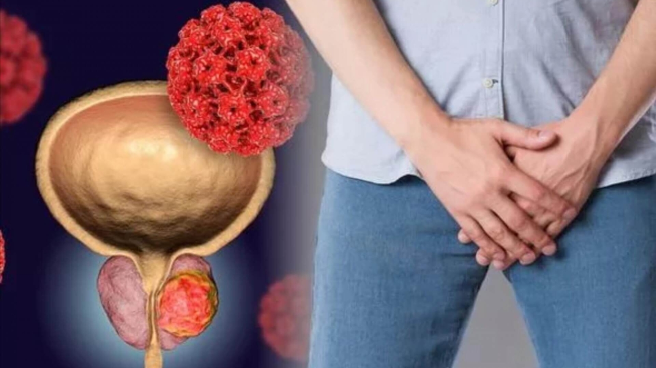 Prostat Büyümesi Nedir?