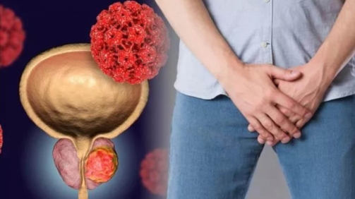 Prostat Büyümesi Nedir?